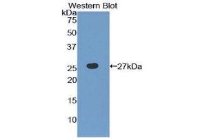 Western Blotting (WB) image for anti-Toll-Like Receptor 6 (TLR6) (AA 608-796) antibody (ABIN1860775) (TLR6 antibody  (AA 608-796))