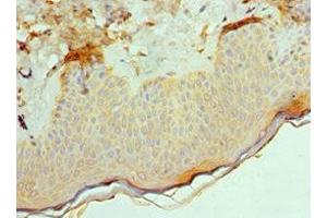 Immunohistochemistry of paraffin-embedded human skin tissue using ABIN7143181 at dilution of 1:100 (ACVR2A antibody  (AA 20-140))