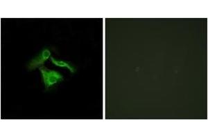 Immunofluorescence analysis of HeLa cells, using GPR149 Antibody. (GPR149 antibody  (AA 451-500))