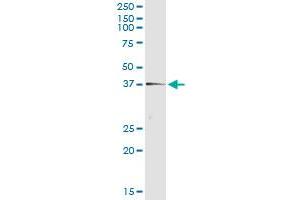 Immunoprecipitation of TEX264 transfected lysate using anti-TEX264 monoclonal antibody and Protein A Magnetic Bead , and immunoblotted with TEX264 MaxPab rabbit polyclonal antibody. (TEX264 antibody  (AA 1-313))