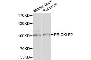 Western blot analysis of extracts of various cell lines, using PRICKLE2 antibody.