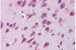 Mouse brain: Formalin-Fixed, Paraffin-Embedded (FFPE) (LAMP1 antibody  (FITC))
