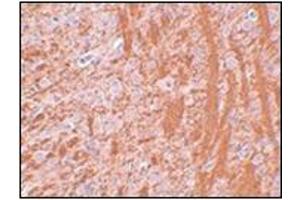 Immunohistochemistry of JMJD6 in rat brain tissue with this product at 2. (JMJD6 antibody  (N-Term))