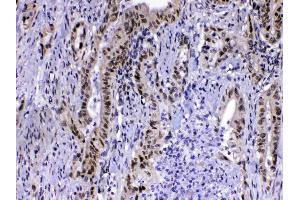 IHC analysis of MED15 using anti-MED15 antibody . (MED15 antibody  (AA 1-285))