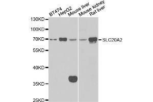 Western blot analysis of extracts of various cell lines, using SLC20A2 antibody (ABIN5974076) at 1/1000 dilution. (SLC20A2 antibody)