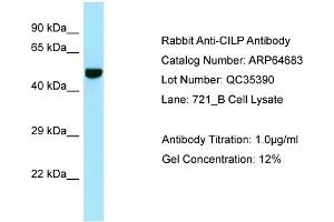 Western Blotting (WB) image for anti-Cartilage Intermediate Layer Protein, Nucleotide Pyrophosphohydrolase (CILP) (C-Term) antibody (ABIN970398) (CILP antibody  (C-Term))