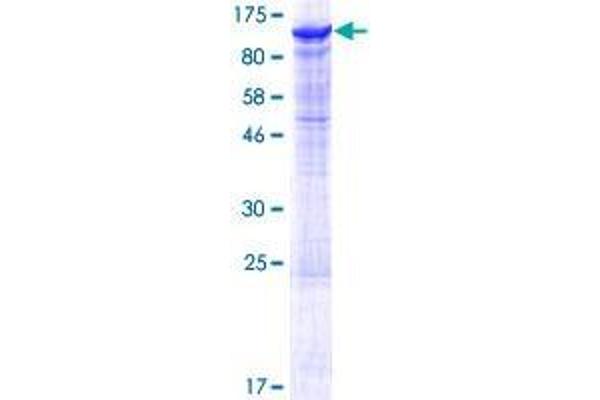 DDHD2 Protein (AA 1-711) (GST tag)