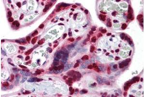 Human Placenta: Formalin-Fixed, Paraffin-Embedded (FFPE) (PTBP1 antibody  (AA 45-145))