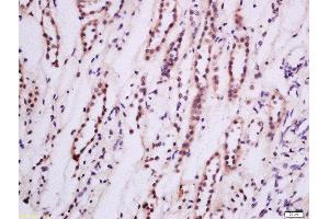 Formalin-fixed and paraffin embedded Human kidney tissue labeled with Anti-PKC epsilon Polyclonal Antibody, Unconjugated 1:200 followed by conjugation to the secondary antibody and DAB staining (PKC epsilon antibody  (AA 631-737))