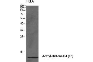 Western Blot (WB) analysis of specific cells using Acetyl-Histone H4 (K5) Polyclonal Antibody. (Histone H4 antibody  (acLys5))
