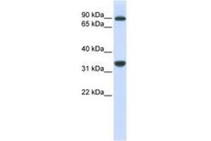 Image no. 1 for anti-Ribosomal RNA Processing 1 Homolog B (RRP1B) (AA 684-733) antibody (ABIN6740938) (RRP1B antibody  (AA 684-733))