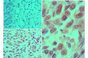 IKK alpha Immunohistochemistry. (IKK alpha antibody)