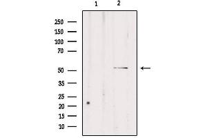 Western blot analysis of extracts from rat brain, using CPE Antibody. (CPE antibody  (Internal Region))