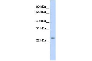 WB Suggested Anti-RAB8A Antibody Titration:  0. (RAB8A antibody  (Middle Region))