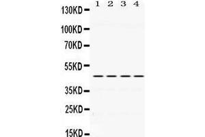 Western Blotting (WB) image for anti-Paired Box 6 (PAX6) (AA 195-233), (Middle Region) antibody (ABIN3043379) (PAX6 antibody  (Middle Region))