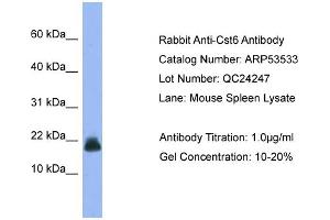 WB Suggested Anti-Cst6  Antibody Titration: 0. (CST6 antibody  (Middle Region))