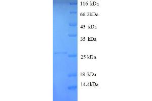 HLA-DPA1 Protein (AA 29-222, Extracellular) (His tag)