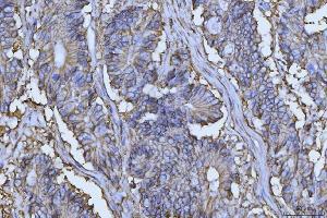 IHC analysis of CD147/Emmprin using anti-CD147/Emmprin antibody (ABIN7599999). (CD147 antibody  (AA 138-323))