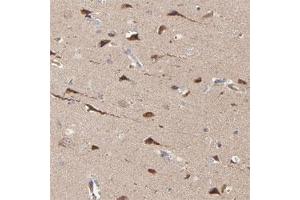Immunohistochemical staining of human cerebral cortex with ABLIM3 polyclonal antibody  shows strong cytoplasmic positivity in neuronal cells.