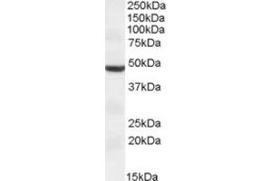 Western Blotting (WB) image for anti-Transmembrane Protease, serine 4 (TMPRSS4) (Internal Region) antibody (ABIN2464170)