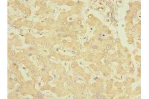 Immunohistochemistry of paraffin-embedded human liver tissue using ABIN7151868 at dilution of 1:100 (EPH Receptor B4 antibody  (AA 300-540))