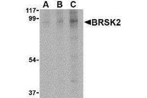 Western blot analysis of BRSK2 in human brain tissue lysate with AP30168PU-N BRSK2 antibody at (A) 0. (BRSK2 antibody  (C-Term))