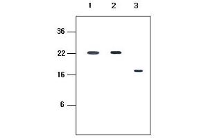 Western blot analysis: Human recombinant protein KIR2DL1, KIR2DL3 and KIR2DL4 (each 20ng per well) were resolved by SDS-PAGE, transferred to PVDF membrane and probed with anti-human KIR2DL4 (1:500).
