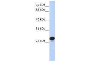 CAPS antibody used at 1 ug/ml to detect target protein. (Calcyphosine antibody  (N-Term))