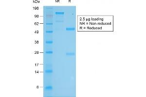 SDS-PAGE Analysis Purified Tyrosinase Rabbit Recombinant Monoclonal Antibody (TYR/2024R). (Recombinant TYR antibody)