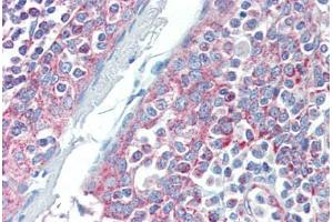 Human Tonsil (formalin-fixed, paraffin-embedded) stained with DIABLO antibody ABIN462354 followed by biotinylated anti-mouse IgG secondary antibody ABIN481714, alkaline phosphatase-streptavidin and chromogen. (DIABLO antibody)
