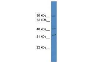Image no. 1 for anti-Plasminogen Activator Inhibitor 1 (SERPINE1) (AA 31-80) antibody (ABIN6745269) (PAI1 antibody  (AA 31-80))