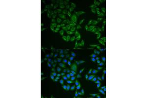 Immunofluorescence analysis of A549 cell using CD247 antibody. (CD247 antibody  (AA 50-164))