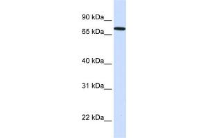 WB Suggested Anti-SETDB2 Antibody Titration:  0.