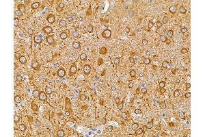 ABIN6263093 and ABIN6279535 at 1/100 staining rat brain tissue by IHC-P.