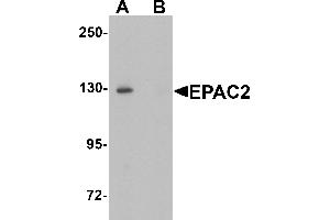 Western blot analysis of EPAC2 in rat liver tissue lysate with EPAC2 antibody at 1 µg/mL in (A) the absence and (B) the presence of blocking peptide.