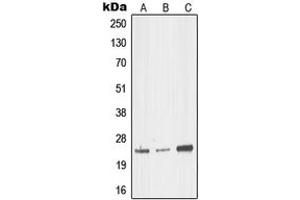 Western blot analysis of MED18 expression in HEK293T (A), mouse brain (B), rat kidney (C) whole cell lysates. (MED18 antibody  (Center))