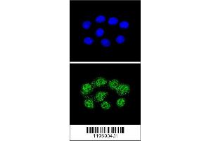 Confocal immunofluorescent analysis of MSH2 Antibody with Hela cell followed by Alexa Fluor 488-conjugated goat anti-rabbit lgG (green). (MSH2 antibody  (AA 637-665))