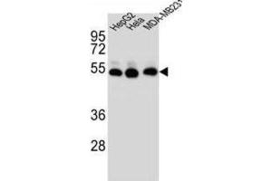 Western Blotting (WB) image for anti-Tubulin, beta 2B (TUBB2B) antibody (ABIN2996447) (TUBB2B antibody)