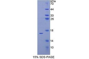 SDS-PAGE (SDS) image for Transcription Elongation Factor B (SIII), Polypeptide 2 (18kDa, Elongin B) (TCEB2) (AA 1-118) protein (His tag) (ABIN4990132)