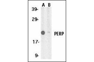 Western blot analysis of PERP expression in A431 whole cell lysates in the absence (A) and presence (B) of blocking peptide with this product at 1 μg /ml. (PERP antibody  (C-Term))
