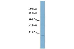 Coactosin-Like 1 antibody used at 1 ug/ml to detect target protein. (COTL1 antibody)