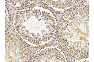 ABIN6256903 and ABIN6275795 at 1/100 staining rat testis tissue by IHC-P. (ANAPC5 antibody  (Internal Region))