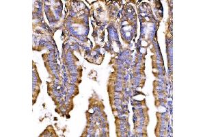 IHC analysis of GPR54/KISS1R using anti-GPR54/KISS1R antibody (ABIN7602153). (KISS1R antibody  (AA 60-373))