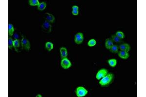 Immunofluorescent analysis of A431 cells using ABIN7170166 at dilution of 1:100 and Alexa Fluor 488-congugated AffiniPure Goat Anti-Rabbit IgG(H+L) (SLC22A9 antibody  (AA 45-143))