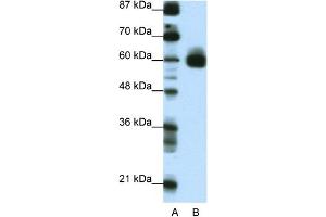 WB Suggested Anti-CIR Antibody Titration:  0. (KCNJ5 antibody  (C-Term))