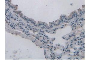 Figure. (Leptin Receptor antibody  (AA 22-203))
