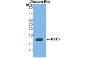 Western Blotting (WB) image for anti-Mannose-Binding Lectin (Protein C) 2, Soluble (MBL2) (AA 129-244) antibody (ABIN1859770) (MBL2 antibody  (AA 129-244))