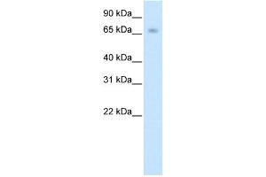 WB Suggested Anti-KBTBD10 Antibody Titration:  0. (Kelch-like protein 41 (KLHL41) (N-Term) antibody)