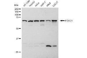 Western blotting analysis using FOXO1 antibody (ABIN7798642).