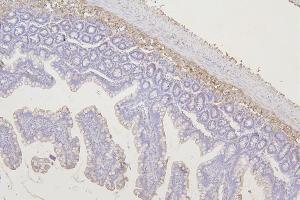 anti-Transmembrane Protein 255B (TMEM255B) (AA 196-240) antibody